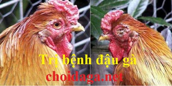Trị bệnh đậu gà dứt điểm nhanh chóng sau 2 ngày 6 bệnh đậu gà